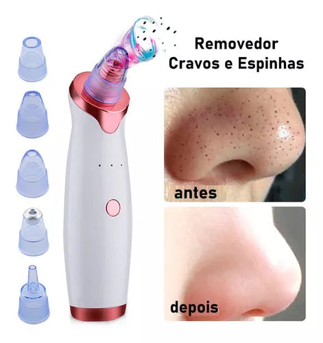 Removedor de cravos Sucção Acne Peeling Limpeza facial Microdermoabrasão Máquina de beleza